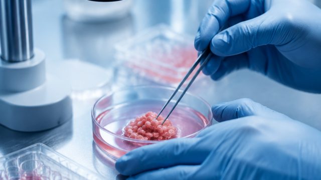 Social: Cell Isolation Market Set for Strong Growth as Demand for Cell Therapy a